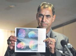 George Visner, ex jugador de los 49ers de San Francisco muestra una copia de un estudio hecho a su cerebro. ESPECIAL  /