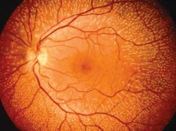 Estas medidas son la base para calcular otras que también describen la morfología de los vasos sanguíneos. ESPECIAL  /