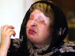 Ameneh Bahrami habla con la prensa después de comunicar su decisión. AFP  /