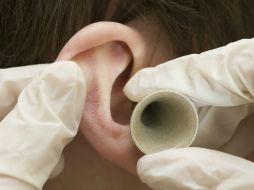 La afectación al oído pueden presentarlas personas jóvenes y adultas con diversos tipos de diabetes. ID  /