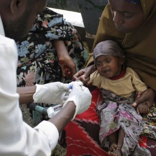 Una epidemia de cólera se suma a la hambruna en la crisis de Somalia