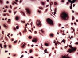 Aún se conoce poco del mecanismo mediante el que las hormonas sexuales femeninas participan en el proceso. ESPECIAL  /