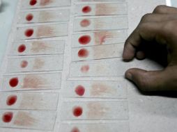 Se muestra un operario colocando muestras de sangre en una clínica de malaria. EFE  /