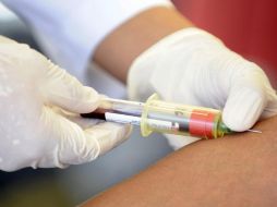 La alerta por la nueva cepa de gonorrea se dio a nivel mundial desde el pasado 15 de julio. ARCHIVO.  /