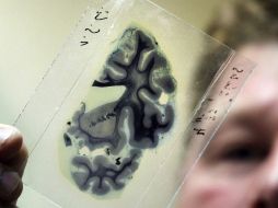 La técnica combina imágenes por resonancia magnética y patrones informáticos para reconstruir extractos de las películas. ARCHIVO  /