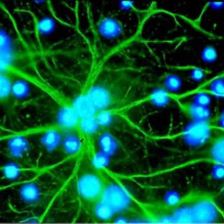 Descubren el papel 'clave' de los astrocitos en la formación del Alzheimer