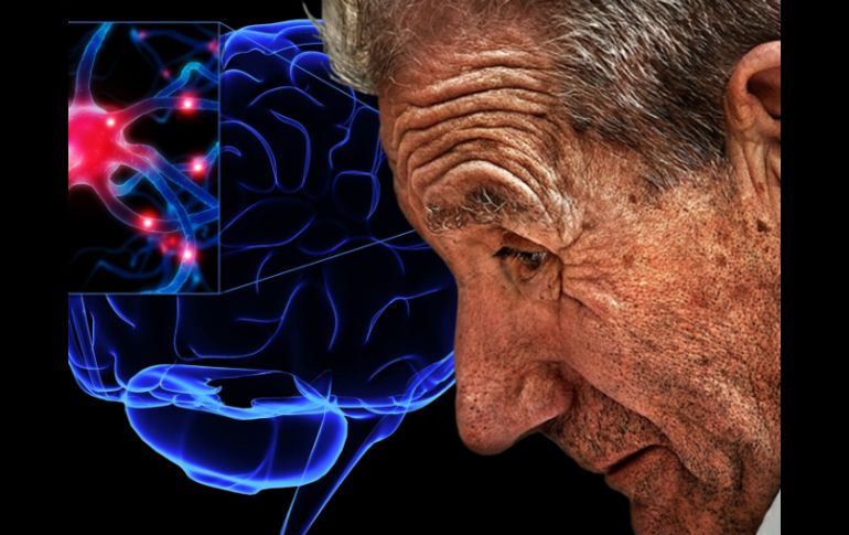 En etapas tempranas es poco probable diagnosticar la enfermedad. ID  /