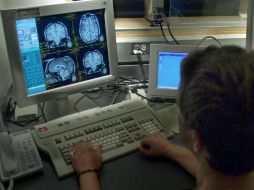 El algoritmo utiliza la información obtenida del primer contraste para ayudar a producir las imágenes posteriores. AP  /