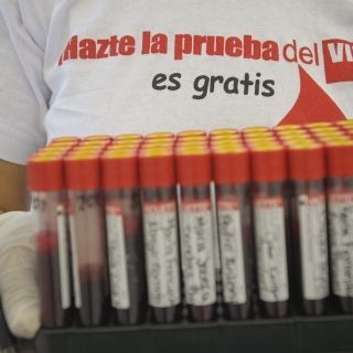 Jalisco ocupa lugar 13 en casos VIH y cuarto en SIDA en México