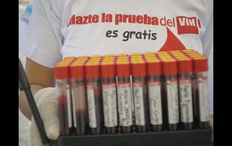 Adultos de 15 a 42 años de edad están ubicados en 225 mil casos que viven con VIH.  /