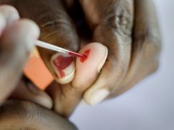Este lunes se dio a conocer que los casos de contagio de sida en el mundo se redujeron un 21% entre 1997 y 2010. AFP  /