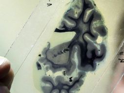 Fueron necesarios cinco años para desarrollar el chip. ARCHIVO EFE  /