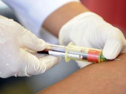 En Jalisco hay 11 mil 993 casos de VIH Sida. ARCHIVO  /