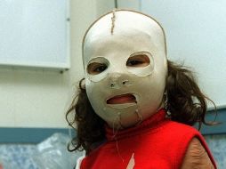 Alrededor de 12 personas del equipo médico de Shriners visitó el Hospital Civil para realizar la evaluación de los menores.  /