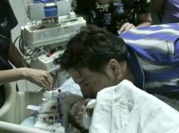 Las bebés estaban unidas por el tórax, abdomen y pelvis. AP  /