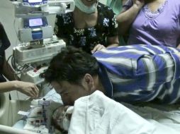 Roberto Paredes padre de las siamesas, besa a su hija después que fuera separada de su hermana. ESPECIAL  /