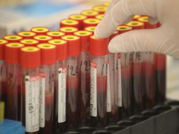 La investigación ha sido publicada en la revista especializada Circulation, de la American Heart Association. ARCHIVO  /