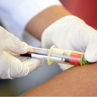 Avance en lucha contra sida es logro científico 2011