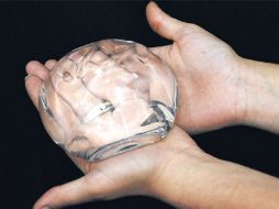 La membrana tiene la ventaja de contener, al menos durante un tiempo, el gel de silicona que haya salido de la prótesis. ESPECIAL  /