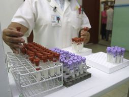 En los experimentos se expusieron a prostitutas y soldados a enfermedades de transmisión sexual. ARCHIVO  /