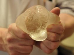 La Cofepris pidió que se haga un plan de manejo de riesgos con los implantes PIP. EFE  /