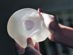 Más de 400 mil mujeres habrían recibido implantes mamarios fabricados por Poly Implant protheses (PIP).  /