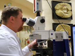 Los resultados de la investigación realizada en el laboratorio serán publicados en una revista de medicina. EFE  /