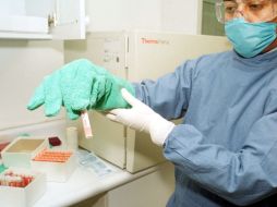 Los investigadores deben identificar aún cuáles son la procedencia más adecuada de células madre para cada uno de los órganos. ARCHIVO  /