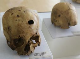 Cráneos impactados por proyectiles son expuestos hoy, viernes 8 de marzo de 2012, en la muestra Puruchuco. Rebelión inca, EFE  /