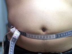 Los malos hábitos en nuestra ingesta alimeticia culminan en obesidad, diabetes, dislipemia, hipertensión y aterosclerosis. ARCHIVO  /