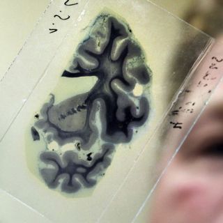 México, en la cima de la investigación neurológica en Latinoamérica