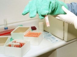 La terapia celular está permitida en el ámbito de las investigaciones clínicas. ARCHIVO  /