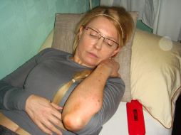 Timoshenko se ha declarado en huelga de hambre tras haber sufrido supuestos malos tratos en prisión. AP  /