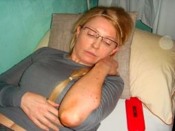 Yulia Timoshenko mostrando las marcas de golpes que, según dice, recibió de funcionarios de la prisión. EFE  /