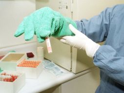 En las células que se dividen con más lentitud se liberan pequeñas cantidades de glicina en el medio de cultivo. ARCHIVO  /