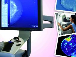 La tecnología inteligente consiste en un sistema computarizado que analiza tomografías digitales. ID  /