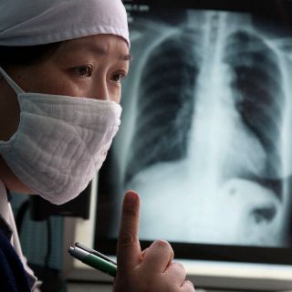 China enfrenta seria epidemia de tuberculosis resistente a fármacos