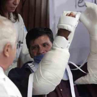 En México realizan primer trasplante de antebrazos