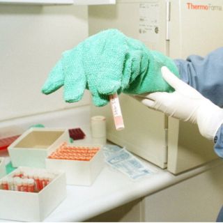 Implantan en niña vena creada a partir de sus células madre