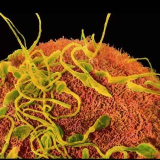 Crean gel que reduce producción de espermas