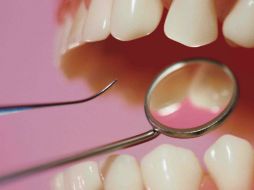 Otro factor que ayuda para sufrir problemas graves en las encías es fumar. AGENCIA ID  /