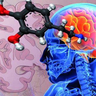 Controlan vía implantes efectos del Párkinson