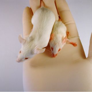 Síndrome de Dravet causa síntomas autistas