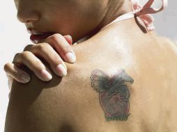 • Si se quiere eliminar los tatuajes hay que buscar los mejores profesionales. THINKSTOCK  /