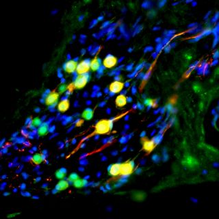 Consideran usar células madre para curar la sordera