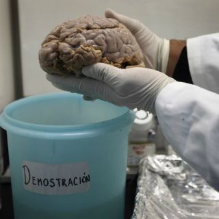 Cerebros humanos son similares pese a diferencia de habilidades