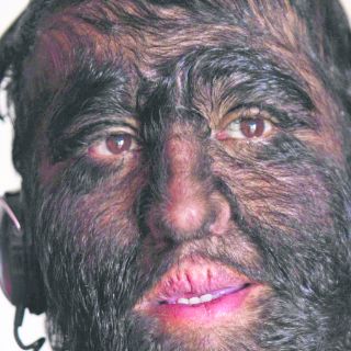 Esta es la historia de un hombre de pelos