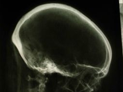 Realizó importantes investigaciones sobre los rayos X. ARCHIVO  /