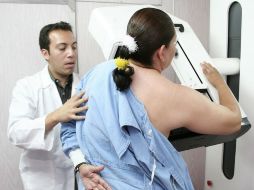 Especialistas recomienda a las mujeres mayores de 40 años realizarse anualmente una mamografía. ARCHIVO  /