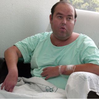 Fundéu BBVA: ''trasplante'' y no ''transplante''